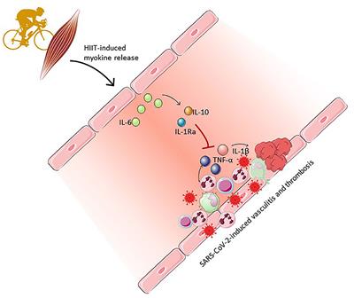 Vascular Inflammation as a Therapeutic Target in COVID-19 “Long Haulers”: HIITing the Spot?